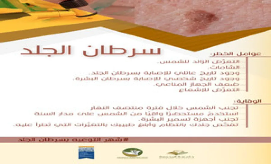 اليوم العالمي لسرطان الجلد -  اليوم العالمي لسرطان الجلد